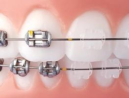 Estetik ve Ortodonti